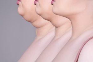 Double chin, skin rejuvenation on the neck, before after anti aging concept, collage of three photos on gray background