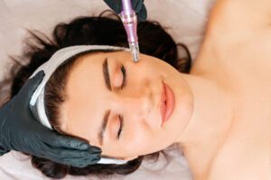 Dermaplaning Treatment