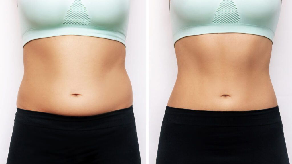 Belly Fat reduction near me