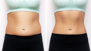 Belly Fat reduction near me