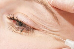 Injection at spa salon. Doctor hands in gloves. Closeup. Pretty female patient. Beauty treatment. Healthy skin procedure. Young women face. Plasmolifting rejuvenation