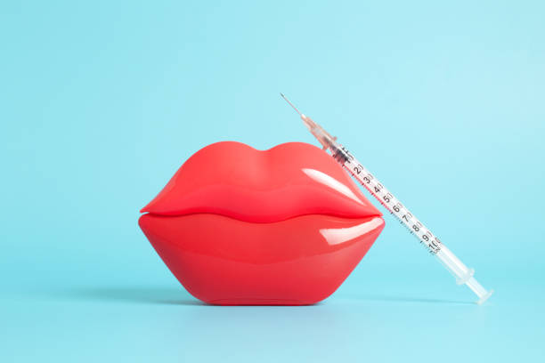 Bright red plastic female lips and a filler and hyaluronic acid injection syringe on a light blue background.