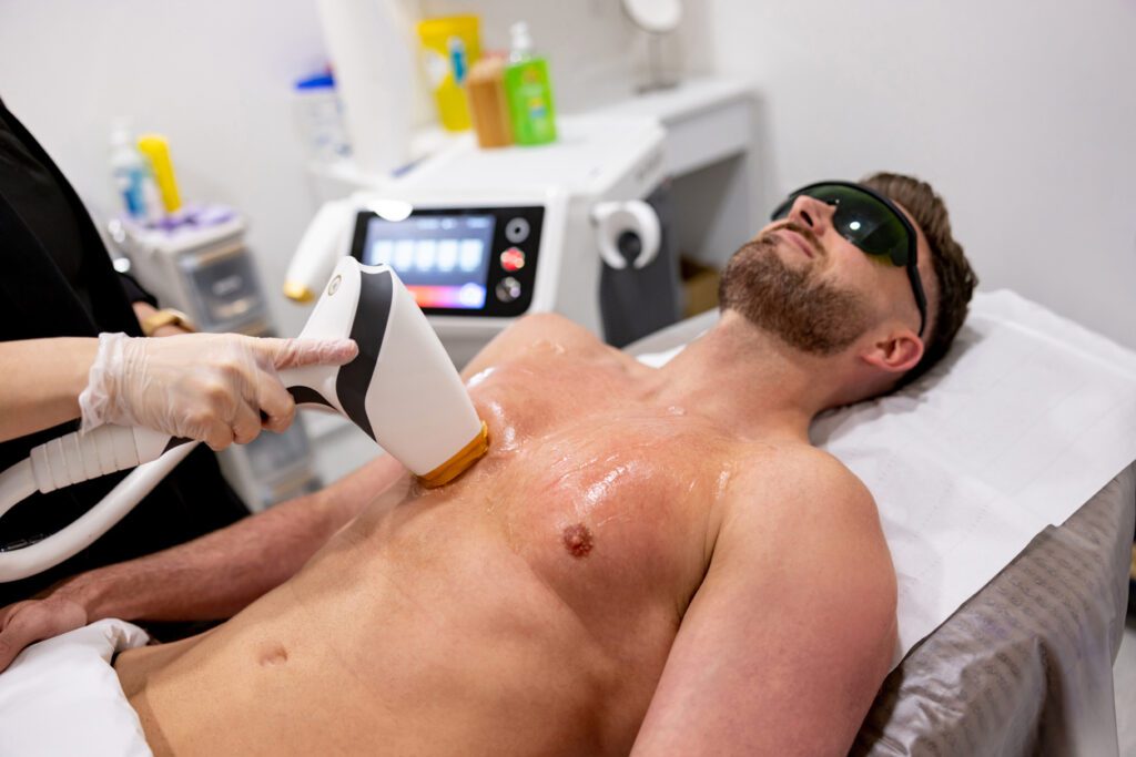 Man getting a laser hair removal on his chest