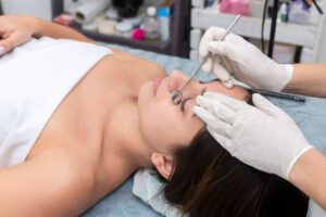 dermaplanning techniques