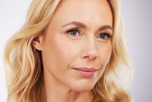 Juvederm Lip Filler Options in Dallas