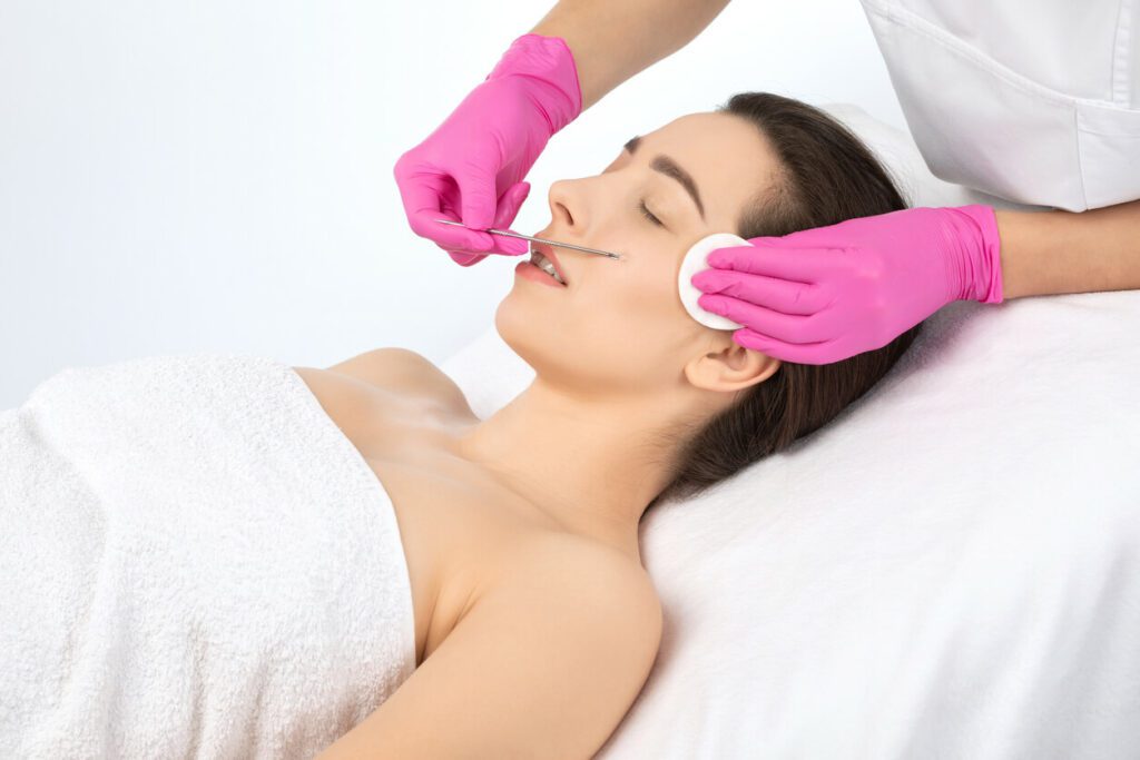 A dermaplaning procedure is in process for cleansing the skin of the face from blackheads and acne.