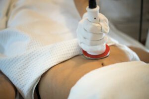 Image of a beauty treatment where a person is receiving Sculptra treatments at the facility.