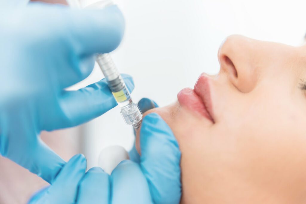 A woman is receiving chin hyaluronic fillers as dermal fillers for chin enhancement.
