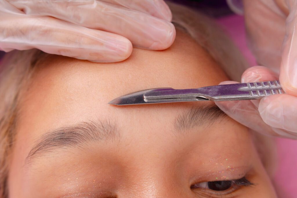 Close-up image of a dermaplaning procedure exfoliating the skin and removing facial hair, performed at an aesthetic clinic.