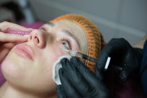 A cosmetologist makes multiple biorevitalization injections to a woman's face under her eyes.